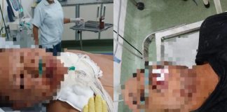 Morador reagiu a roubo na residência e dois criminosos foram baleados em briga no estado de Mato Grosso