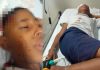 Uma criança que foi agredida com paulada tem o crânio afundado e precisará passar por uma cirurgia em Cuiabá