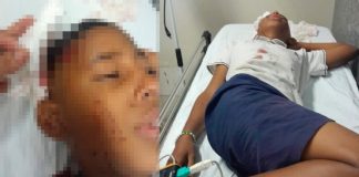 Uma criança que foi agredida com paulada tem o crânio afundado e precisará passar por uma cirurgia em Cuiabá
