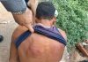 Um homem foi amarrado a fios de energia e agredido com uma ripa de madeira por suspeitar de pertencer a uma facção criminosa