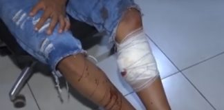 Durante uma perseguição policial, um motociclista sem habilitação e “dando bala” acaba sendo atingido por um disparo