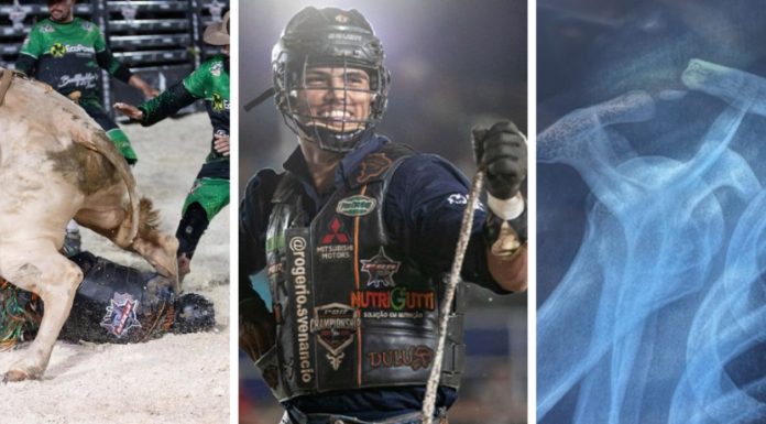 Campeão Brasileiro de Montaria em Touro, Rogério Venâncio Sofre Fratura Durante Competição