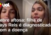 Tays Reis emite um aviso após sua filha receber o diagnóstico de febre aftosa
