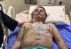 Bolsonaro passa por cirurgia após crise de soluço