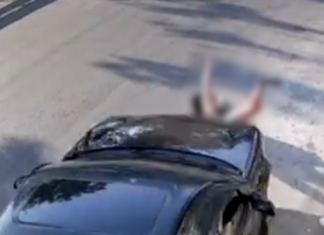 Teve Pernas Amputadas: Mulher arrastada foi vítima de tentativa de feminicídio, diz delegado