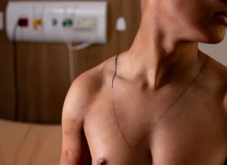 Jovem atingido por raio em ato de Nikolas teve hemorragia no ouvido