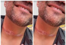 Secretário municipal sofre acidente com cabo solto e quase é gravemente ferido na capital